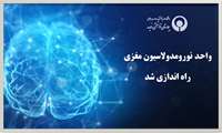 واحد « نورومدولاسیون مغزی » در بخش فیزیوتراپی بیمارستان توانبخشی رفیده راه اندازی شد